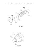 IMPLANT PLACEMENT SYSTEMS, DEVICES AND METHODS diagram and image