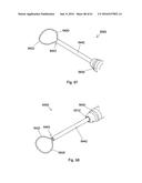 IMPLANT PLACEMENT SYSTEMS, DEVICES AND METHODS diagram and image