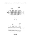 IMPLANT PLACEMENT SYSTEMS, DEVICES AND METHODS diagram and image