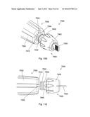 IMPLANT PLACEMENT SYSTEMS, DEVICES AND METHODS diagram and image