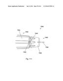 IMPLANT PLACEMENT SYSTEMS, DEVICES AND METHODS diagram and image