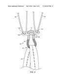 CLOSED LOOP SUTURE FOR ANCHORING TISSUE GRAFTS diagram and image