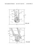 CLOSED LOOP SUTURE FOR ANCHORING TISSUE GRAFTS diagram and image