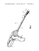 SURGICAL STAPLING APPARATUS diagram and image