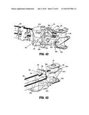 SURGICAL STAPLING APPARATUS diagram and image