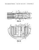 SURGICAL STAPLING APPARATUS diagram and image