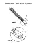 SURGICAL STAPLING APPARATUS diagram and image