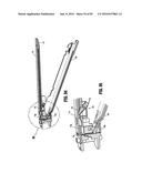 SURGICAL STAPLING APPARATUS diagram and image