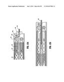 SURGICAL STAPLING APPARATUS diagram and image