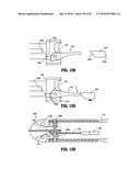 SURGICAL STAPLING APPARATUS diagram and image