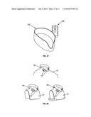 Methods and Devices to Reduce the Likelihood of Injury from Concussive or     Blast Forces diagram and image