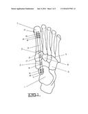 Method and Apparatus for Repairing the Mid-Foot Region Via and     Intramedullary Nail diagram and image