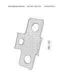 BONE PLATE FOR REDUCING ANGULAR BONE DEFORMITY AND METHOD OF USING diagram and image