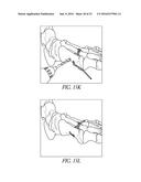 BONE PLATE FOR REDUCING ANGULAR BONE DEFORMITY AND METHOD OF USING diagram and image