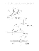 BONE IMPLANTS FOR THE TREATMENT OF INFECTION diagram and image