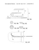 BONE IMPLANTS FOR THE TREATMENT OF INFECTION diagram and image