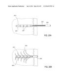 BONE IMPLANTS FOR THE TREATMENT OF INFECTION diagram and image