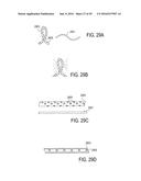 BONE IMPLANTS FOR THE TREATMENT OF INFECTION diagram and image