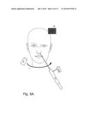 Computer-Implemented Technique For Determining A Coordinate Transformation     For Surgical Navigation diagram and image