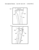 SYSTEM FOR SURGICAL INFORMATION AND FEEDBACK DISPLAY diagram and image