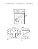 SYSTEM FOR SURGICAL INFORMATION AND FEEDBACK DISPLAY diagram and image