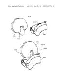 SYSTEM FOR SURGICAL INFORMATION AND FEEDBACK DISPLAY diagram and image