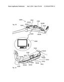 SYSTEM FOR SURGICAL INFORMATION AND FEEDBACK DISPLAY diagram and image