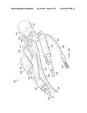 Robotic Devices and Systems for Performing Single Incision Procedures and     Natural Orifice Translumenal Endoscopic Surgical Procedures, and Methods     of Configuring Robotic Devices and Systems diagram and image