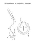 Robotic Devices and Systems for Performing Single Incision Procedures and     Natural Orifice Translumenal Endoscopic Surgical Procedures, and Methods     of Configuring Robotic Devices and Systems diagram and image