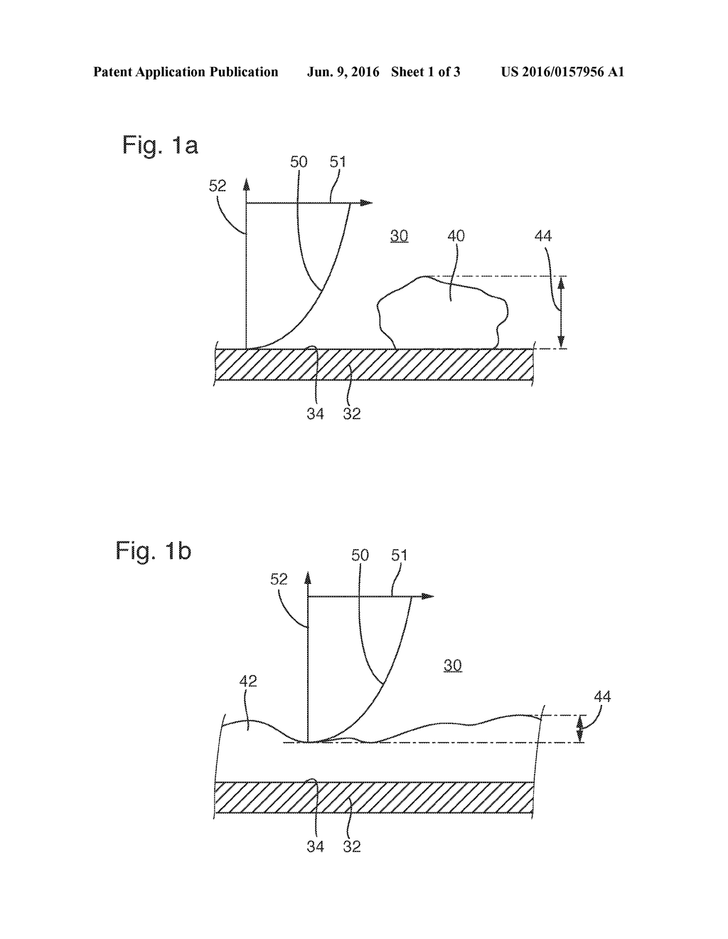 METHOD AND DEVICE FOR CLEANING A SURGICAL INSTRUMENT - diagram, schematic, and image 02