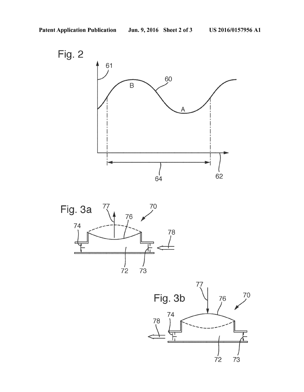 METHOD AND DEVICE FOR CLEANING A SURGICAL INSTRUMENT - diagram, schematic, and image 03