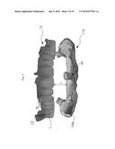 METHOD FOR MANUFACTURING SURGICAL GUIDE AND CROWN, ABUTMENT IN MOUTH FOR     DENTAL IMPLANT diagram and image