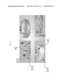 METHOD FOR MANUFACTURING SURGICAL GUIDE AND CROWN, ABUTMENT IN MOUTH FOR     DENTAL IMPLANT diagram and image