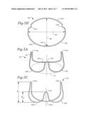 PROSTHETIC MITRAL VALVE diagram and image