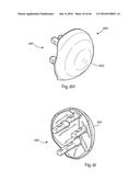 HUMERAL ARTHROPLASTY diagram and image