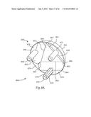 HUMERAL ARTHROPLASTY diagram and image