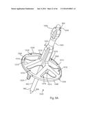 HUMERAL ARTHROPLASTY diagram and image