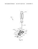 HUMERAL ARTHROPLASTY diagram and image