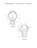 HUMERAL ARTHROPLASTY diagram and image