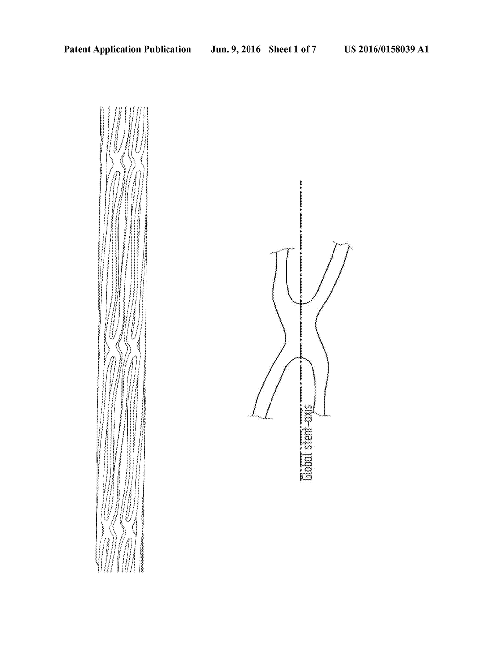 MEDICAL DEVICE FOR INSERTING INTO A HOLLOW ORGAN OF THE BODY - diagram, schematic, and image 02