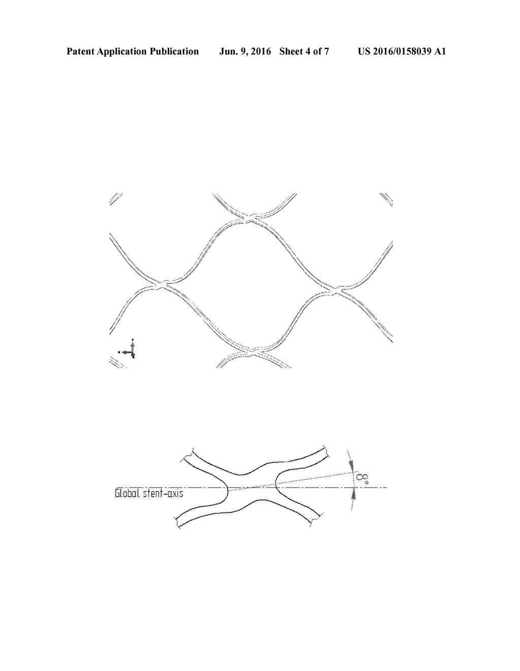 MEDICAL DEVICE FOR INSERTING INTO A HOLLOW ORGAN OF THE BODY - diagram, schematic, and image 05