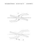 MEDICAL DEVICE FOR INSERTING INTO A HOLLOW ORGAN OF THE BODY diagram and image