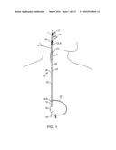 Systems And Methods For Treating A Carotid Artery diagram and image