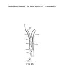 Systems And Methods For Treating A Carotid Artery diagram and image