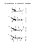 Systems And Methods For Treating A Carotid Artery diagram and image