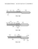 Systems And Methods For Treating A Carotid Artery diagram and image