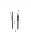 Systems And Methods For Treating A Carotid Artery diagram and image