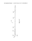 Systems And Methods For Treating A Carotid Artery diagram and image