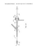 Systems And Methods For Treating A Carotid Artery diagram and image