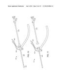 Systems And Methods For Treating A Carotid Artery diagram and image